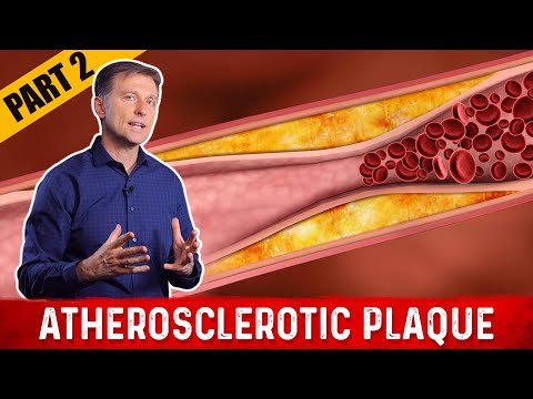 Weird Symptoms Explained by Dr Berg