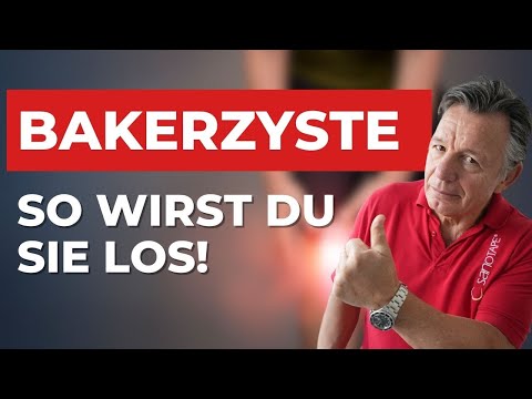 Du hast eine Bakerzyste? So kannst du dir selbst helfen!