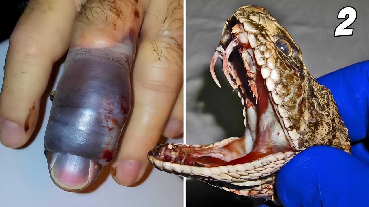 THE MOST POISONOUS SNAKES IN BRAZIL [PART 2]