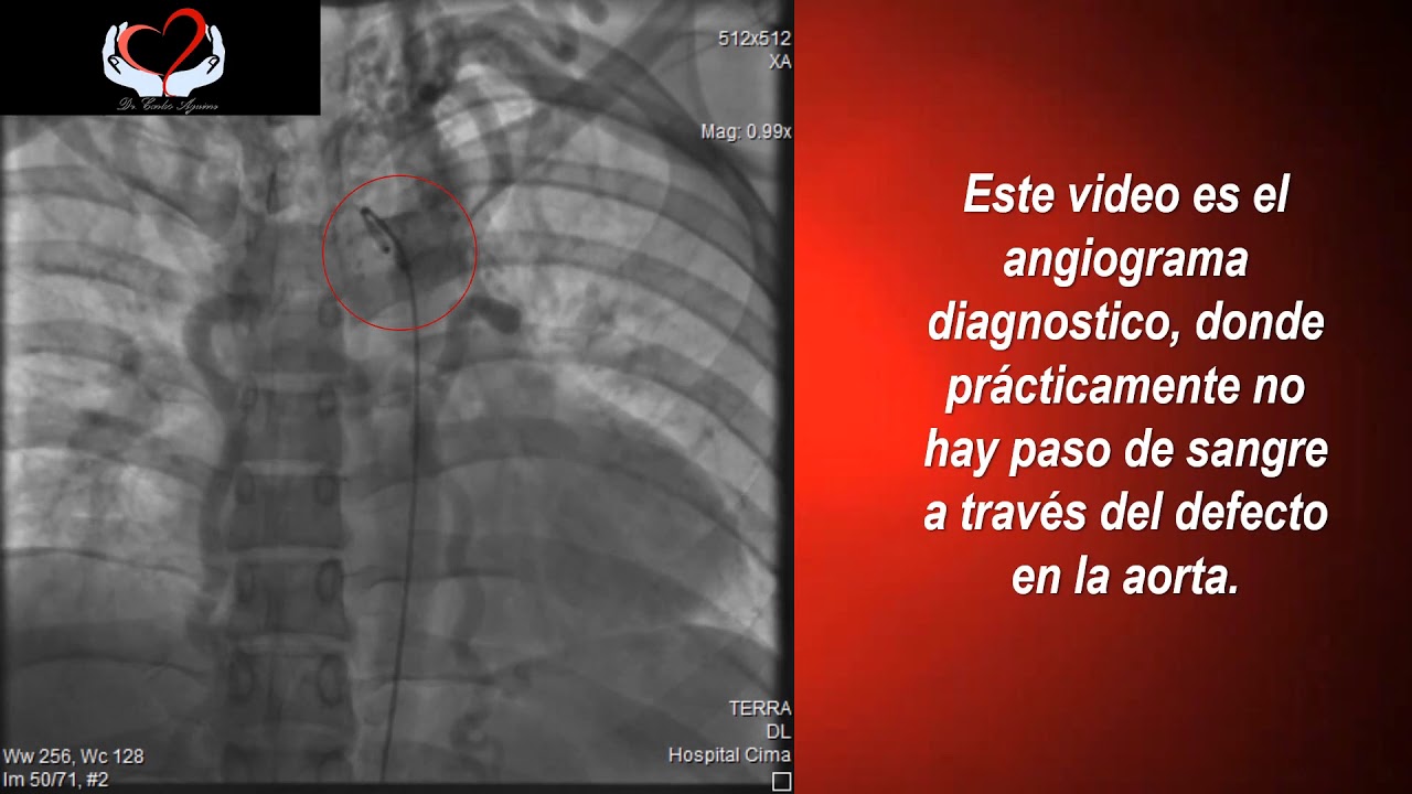 Carlos Alberto Aguirre Molina-14