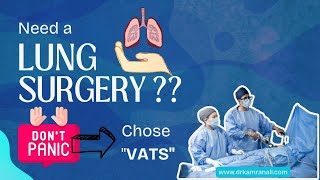 Lung Surgery : Scared ??  Choose VATS