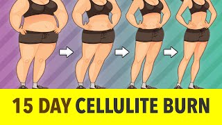 15 Day Cellulite Burn Workout