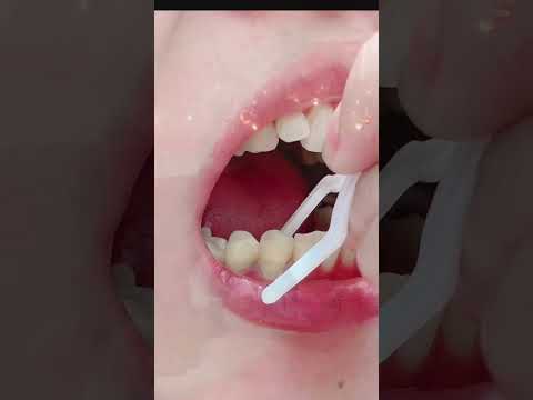 快閃優惠: 買一包送一包(免運再加送牙菌斑顯示劑)