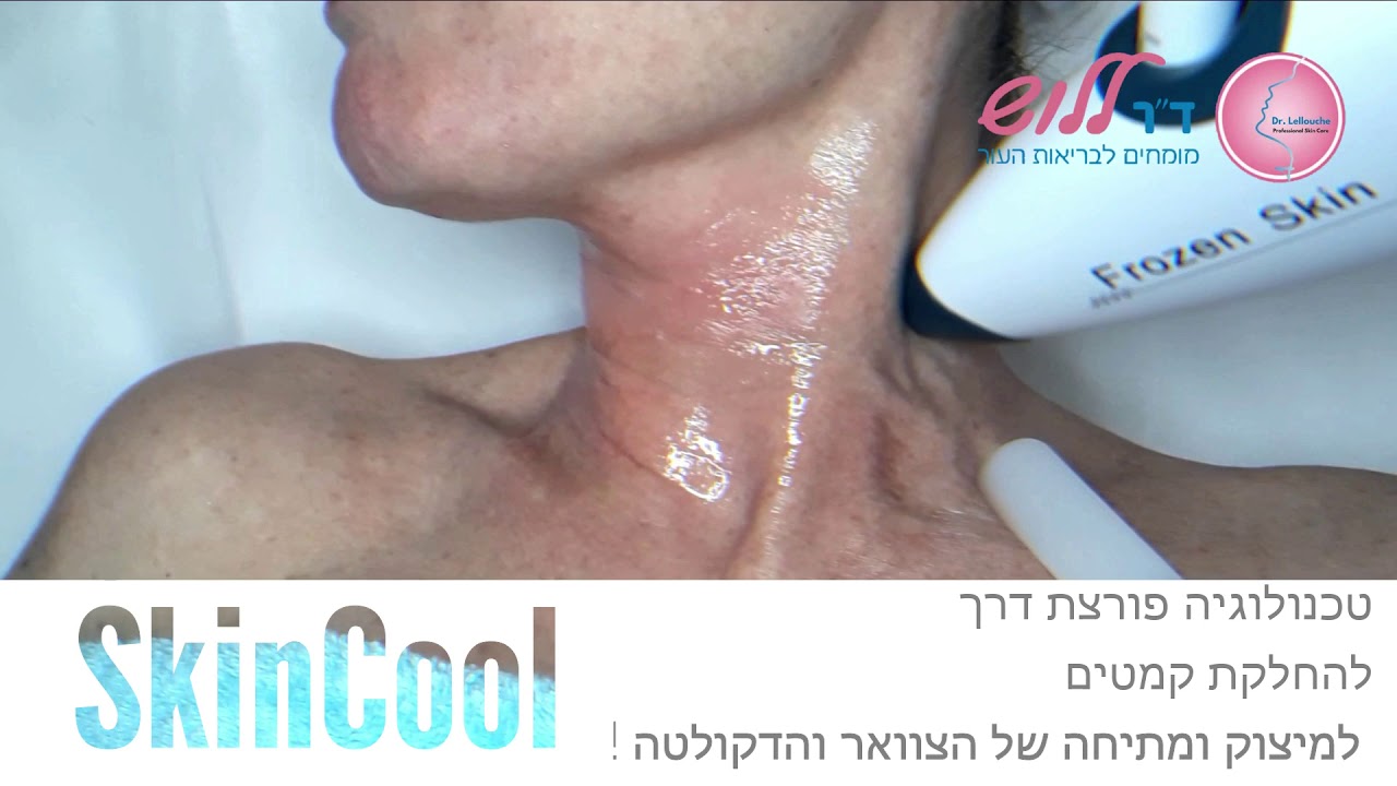 SkinCool- למתיחה ומיצוק של הצוואר והדקולטה ב- 5 דקות​