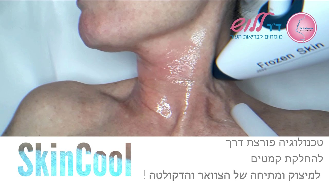 SkinCool- למתיחה ומיצוק של הצוואר והדקולטה ב- 5 דקות