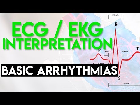 Basic Arrhythmias | Sinus, Brady, Tachy, Premature Beats | ECG EKG Interpretation (Part 3)