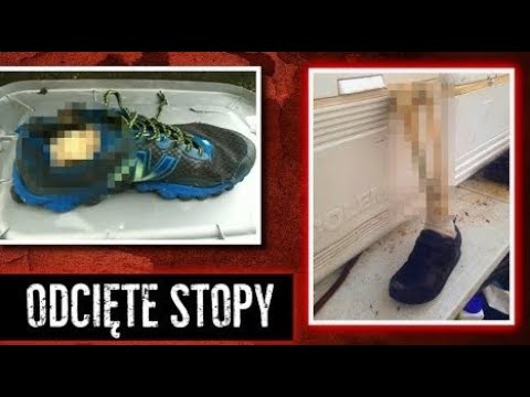 Koślawego dr Komarovsky Palce w szyszkach