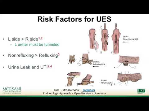 Genital Surgery in the Transmale Patient; Ureterenteric Stricture Revision < Urology