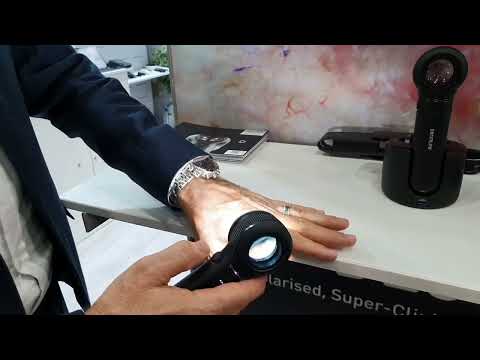 How to use the DermLite DL5 Dermatoscope