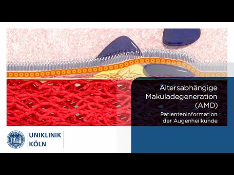 Altersabhängige Makuladegeneration (AMD)