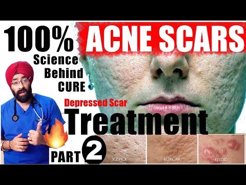 SCIENCE BEHIND ACNE SCARS #2 | PITS & PORES TREATMENT Explained in ENG by Dr.Education | Part 2 of 3
