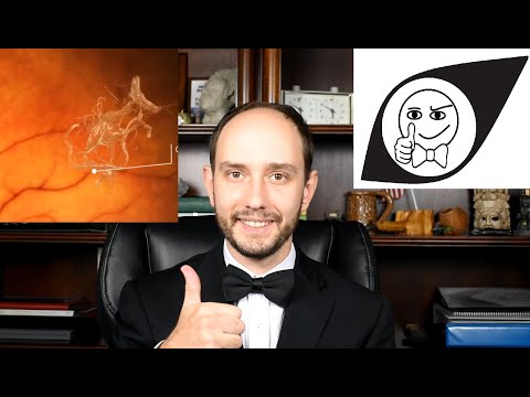 Eye Experts: Flashes and Floaters from Posterior Vitreous Detachment (PVD)