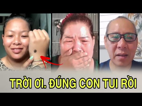 (2020) The mother covered her face and cried when she saw the birthmark on her child's hand. She ...