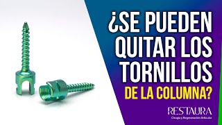 ¿Se pueden quitar los tornillos de la columna
