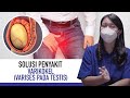 Varikokel Gejala Penyebab Dan Cara Mengatasi Kata Dokter