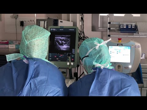 Miniature Vidéo Laser Endoveineux