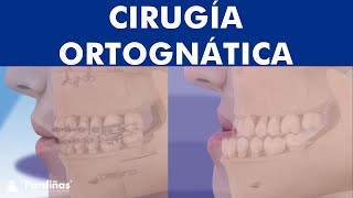 Cirugía ortognática y ortodoncia -  ¿En qué consiste? ©