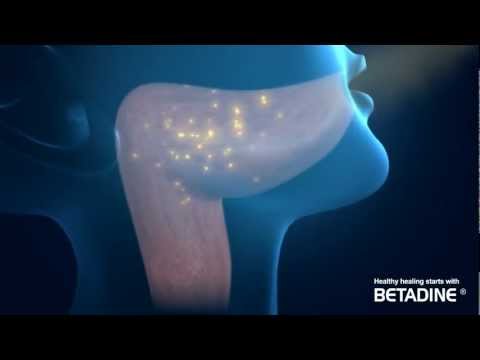 BETADINE Gargle and Mouthwash