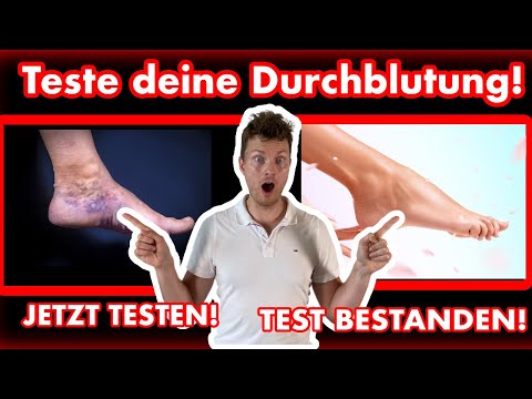 The truth about healthy feet: Test your blood flow now!