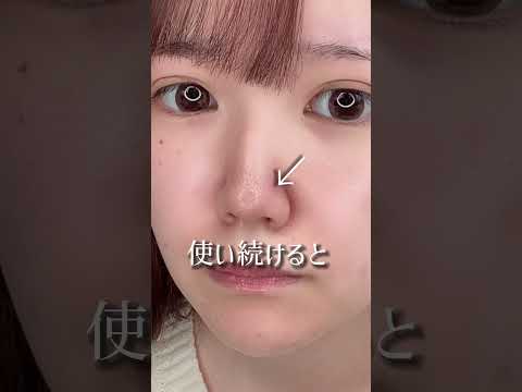 ミューズパックについて詳しく解説