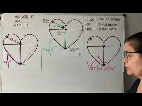 ECG Analyzing Rhythm