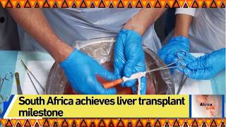 South Africa achieves liver transplant milestone
