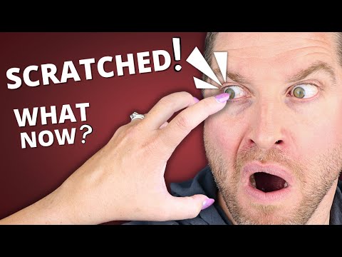 Scratched Eye!? - What You NEED To Know // Corneal Abrasion (Symptoms, Treatment)