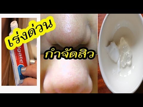 สืบความอ่อนแอ วิตามินเพื่อเพิ่มความแข็งแรง