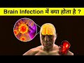 ब्रेन में इंफेक्शन होने से क्या होता ह