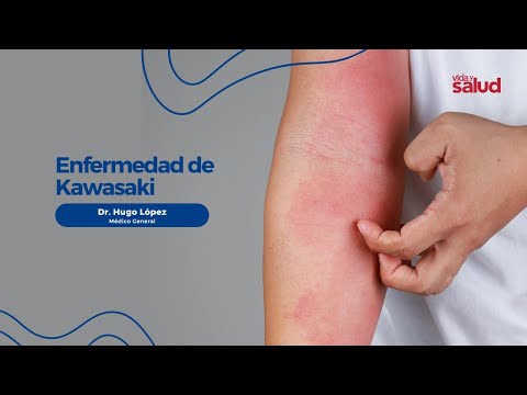 VIDA Y SALUD - ENFERMEDAD DE KAWASAKI