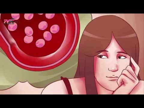 Këshilla mjekësore - Përfitimet shëndetësore të qershive