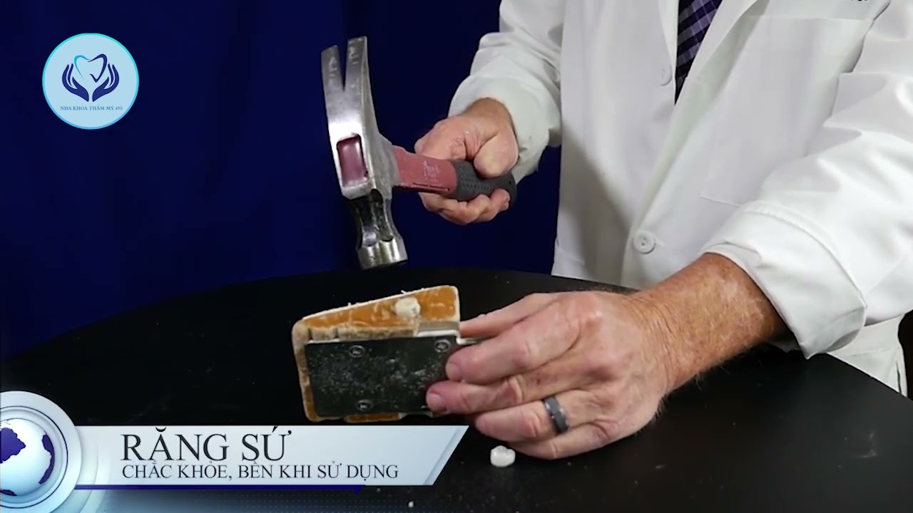 Test độ bền răng sứ nha khoa thẩm mỹ 470