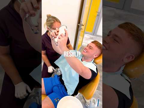 Let Your Smile Shine with Monolithic Zirconia Crowns in Turkey!