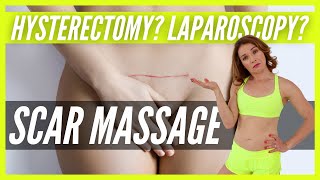 Hysterectomy Incision Healing | HOW & WHY YOU NEED TO MASSAGE Laparoscopic Hysterectomy Scars