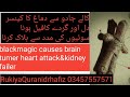 Blackmagic Treatment Cause Brain Heart Attack Kidney Failure Lungs RukiyaQuranidrhafiz Urdu Hindi