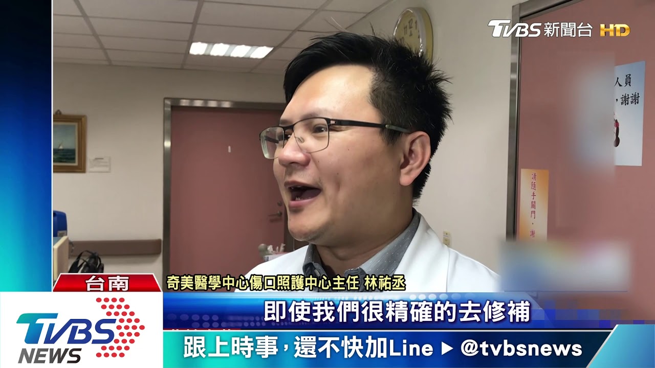照鏡子雙手重壓「洗手台垮」10歲男童濺血