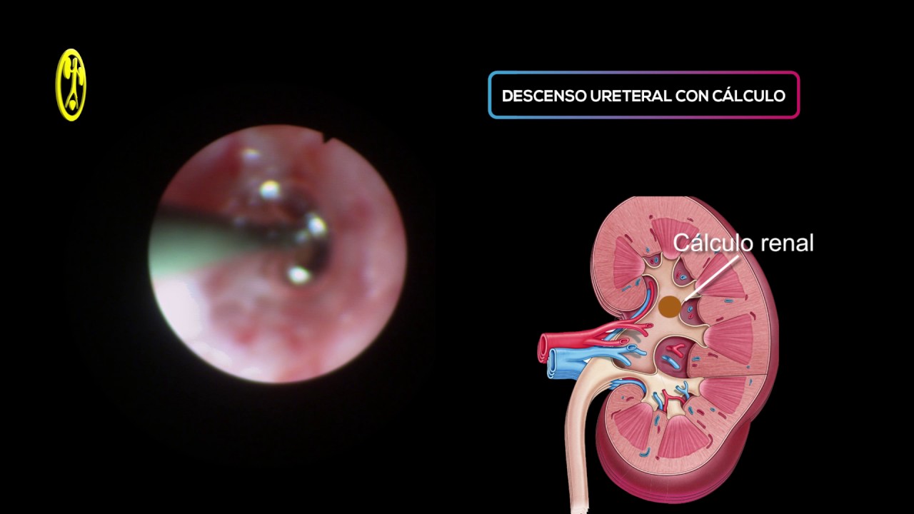 Abraham López Zepeda-10