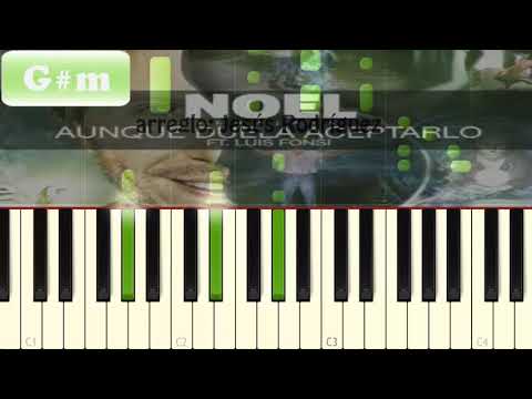 Aunque Duela Aceptarlo - Noel Schajris