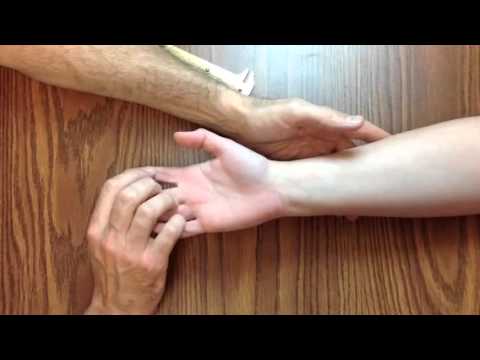 Hand Exam For Carpal Tunnel Syndrome