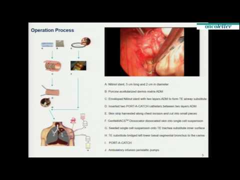 Qiang Tan, Shanghai Chest Hospital, China