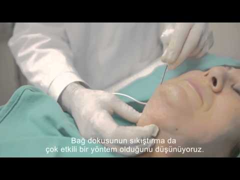 download lagu mp3 mp4 Www Thermi, download mp3 Www Thermi free downloadn, video klip Www Thermi