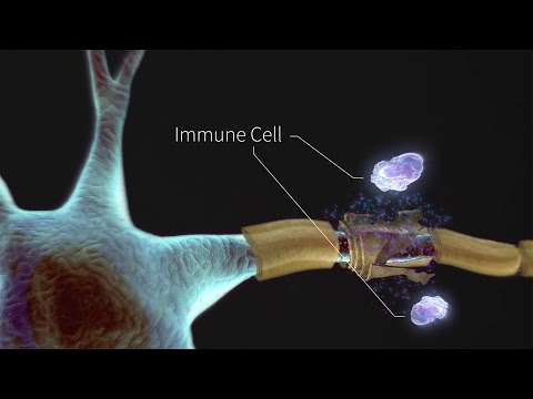 What is Multiple Sclerosis?