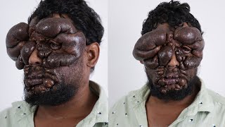 Help Ravikumar Get A New Face video