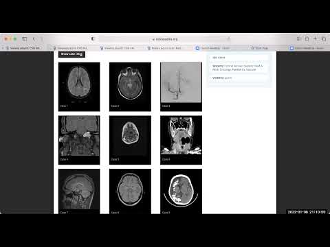 TEAM FRCR 2B Viva Practice Session (CNS Module). 8th Jan, 2022