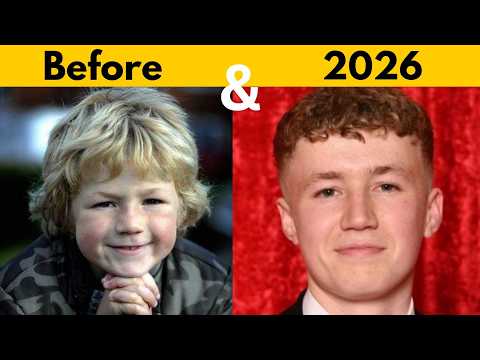 30 British Tv Actors - Before Vs After