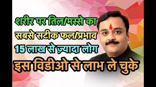 शरीर के तिल, मस्सा आदि का जीवन में महत्व, Janiye Sharir par Til aur Masse Ka Prabhav, Mahatva