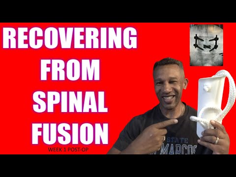 TLIF Fusion Surgery Recovery L4 L5 Week 1-𝐘𝐎𝐔 𝐍𝐄𝐄𝐃 𝐓𝐇𝐄𝐒𝐄 𝐆𝐀𝐃𝐆𝐄𝐓𝐒!