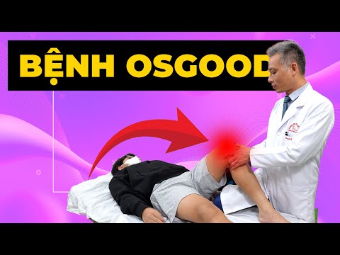 Bệnh Osgood Làm Con Bạn Đau Đớn Mỗi Khi Chạy Nhảy? Cách Điều Trị Hiệu Quả