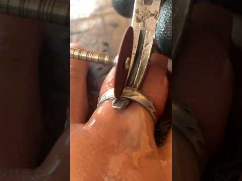How I Fixed My Stuck Ring With Metal!Corte de anillo 💍⛑️ CUERPO DE BOMBEROS COROZAL-SUCRE