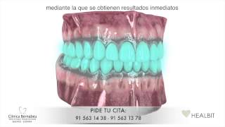 Blanqueamiento dental - Nadia Sarmini Fernández